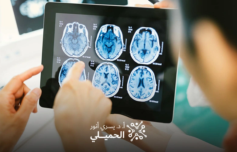 دكتور اعصاب واهم العمليات الجراحية التي يقوم بها في السعودية