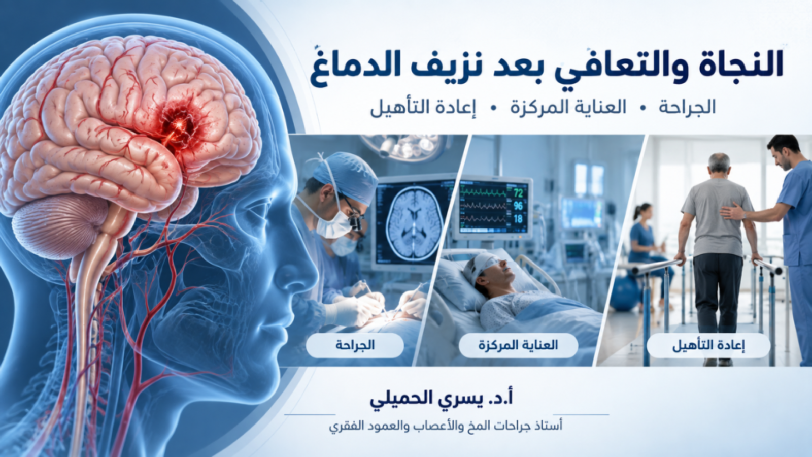 الناجون من نزيف الدماغ: فرص التعافي ونسبة نجاح عمليات نزيف المخ