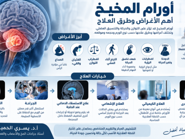 أورام المخيخ: أهم 7 أعراض وطرق التشخيص والعلاج