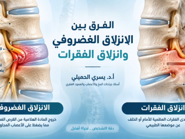 الفرق بين الانزلاق الغضروفي وانزلاق الفقرات