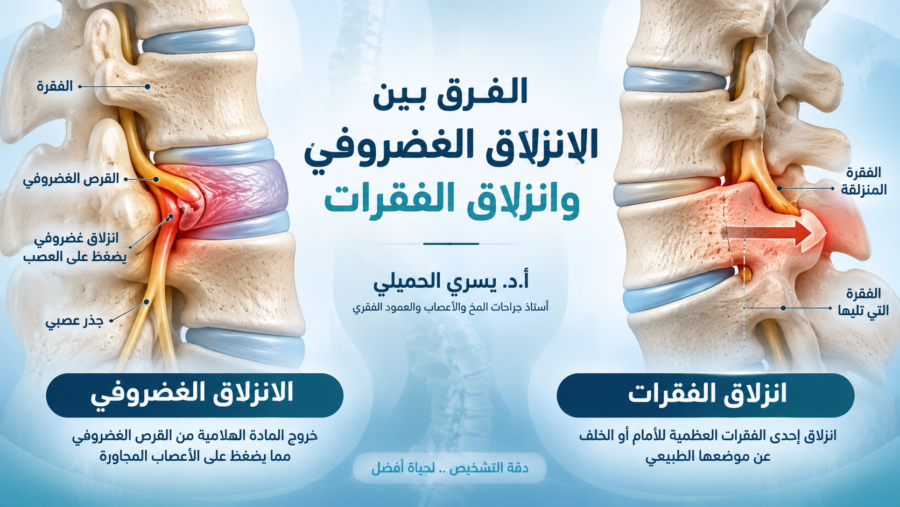 الفرق بين الانزلاق الغضروفي وانزلاق الفقرات